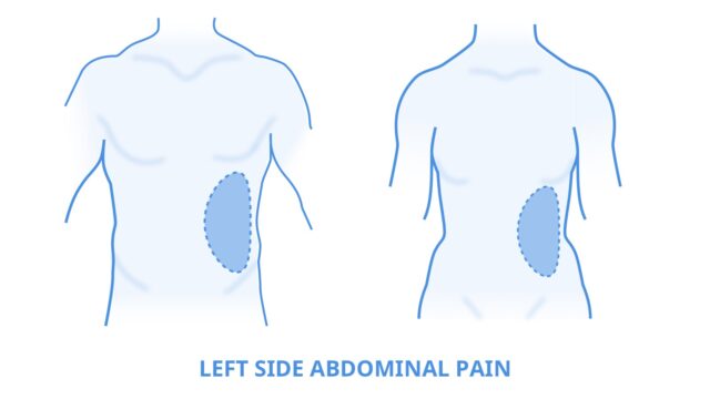 ألم اسفل البطن في الجهة اليسرى